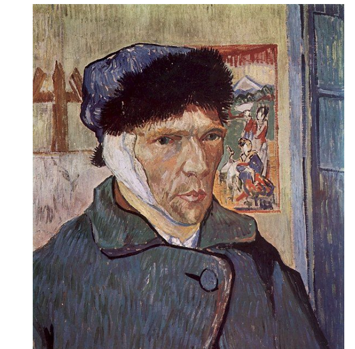 Van Goghs øre
